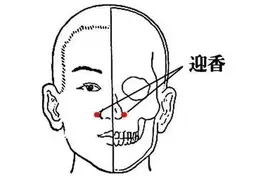 亲测真的管用，这样做能让过敏性鼻炎没那么难受图片