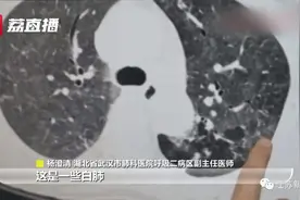 男子喜欢吹奏……竟然导致双肺发白，医生紧急提醒图片