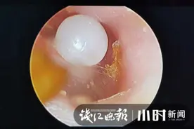 游乐场玩耍归来，这个小东西害得3岁女孩进了手术室图片