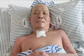 这份团圆来得太不容易！杭州煤气爆燃严重烧伤的快递小哥转入康复医院图片