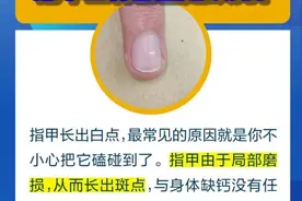 指甲上的月牙少，身体就不好？图片