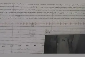 “秒睡”竟是一种病图片