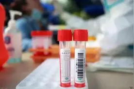 核酸管里的红色液体是什么？记者带你找答案图片