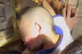 “睡神附体”！广东一男孩手卡门缝，脱困才醒图片