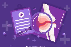 为什么会发生关节炎？图片