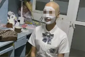 22岁女大学生剃光头：多次烫染致干枯脱落，想从头再来改善发质图片