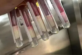 8岁女孩抽出来的血像牛奶一样！原因成谜图片