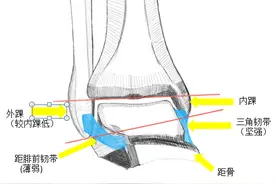 【健康科普】踝关节扭伤的处理图片