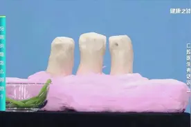 牙齿松动、敏感、牙龈出血……你的牙健康吗？图片