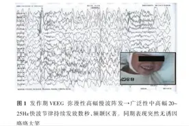 孩子无缘无故发笑，可能是病，家长要警惕了图片