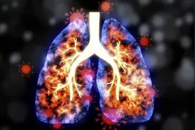 为什么有些人得肺癌后能治好，有些人却很不幸？医生说出了原因图片