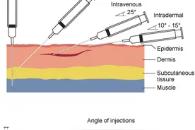 小时候常打的“屁股针”，为什么现在变少了？图片