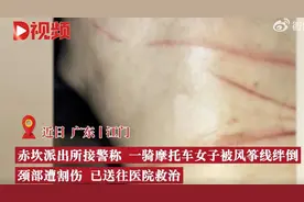 女子骑车脖子遭风筝线割伤，别只顾自己任“线”却给他人“埋雷”图片