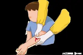乳腺癌防治月：乳腺癌术后淋巴水肿的“预防之道”图片