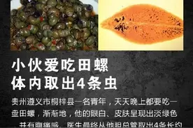 急转！千万别生吃！生吃这些食物可能感染寄生虫图片