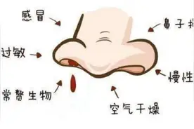 【健康科普】疫情期间鼻出血了该怎么办？图片