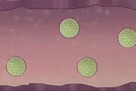 警惕！身上5种疣跟HPV病毒有关！图片