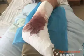 婴儿坠楼，警校生跳3米墙营救：骨折也不后悔，救人是首位图片