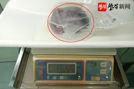 “坐在气球上出生”，男婴屁股长了个1.3斤畸胎瘤图片