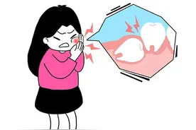 智齿要不要拔掉？拔智齿前有哪些准备工作？这些事项，你要知道图片