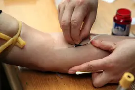 警惕！体检报告出现这些字眼，可能是癌症信号图片