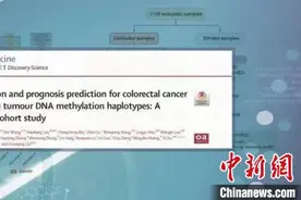 中国专家研发新检测手段：或实现早期结直肠癌无创精准筛查图片