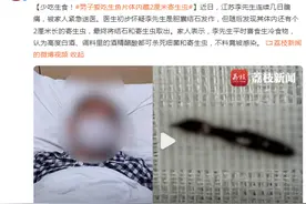 少吃生食！男子爱吃生鱼片，体内藏2厘米寄生虫图片