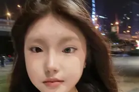 长沙18岁女孩一只眼天生蓝瞳，曾被视为异类！网友：她的眼睛将星海藏在眼底图片