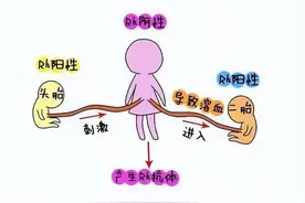 “熊猫血”宝宝发生溶血怎么办？图片