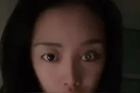 90后女孩车祸失去右眼后成义眼师：练习千余次才学会，曾是舞蹈演员，18岁突遭变故图片