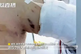 三人注射溶脂针，瘦身不成反倒皮肤严重溃烂！医生提醒……图片