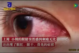 错误佩戴隐形眼镜，或致失明！这几类人不建议使用→图片