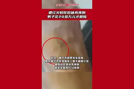 在小区遭红火蚁咬后休克摔倒，被送ICU抢救！南宁一男子花20多万元才脱险图片