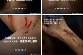 杜蕾斯不打“擦边球”，发布反家暴海报直抵人心图片