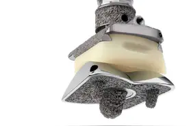 预告｜脚脖子疼别大意，严重了要换图片