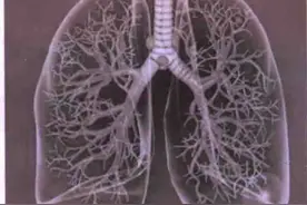 如何正确面对肺结节？听听军医怎么说图片