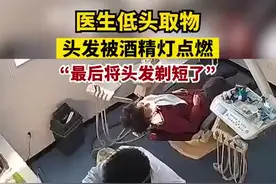 医生在诊室内低头取物时，头发不慎被酒精灯点燃图片