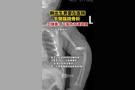 刚出生男婴手臂在医院蹊跷骨折，滁州市卫健委：正多方沟通调查图片