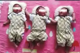 浏阳三胞胎大宝患罕见病离世 父母捐献其遗体角膜助他人新生图片