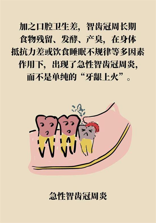 经常出现牙龈肿痛、上火，请注意这些问题！