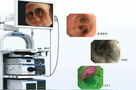 【悦护理】你了解支气管镜检查吗？图片