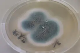 女子眼睛里长“蘑菇”，竟是这种病惹的祸图片