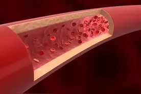 心血管病患者注意！损伤血管有“五毒”，吸烟危害最大图片