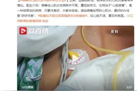 病毒性心肌炎没传说中那么可怕 医生：重症较罕见图片