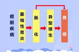 胃炎到胃癌需要几步？两项检查，有效预防胃癌图片