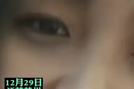 女子称感染新冠后长出浓密胡子，本人回应：唇毛一直比较重图片