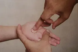 孩子发烧试试这几种中医退热方，简单易学图片