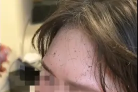 火烧眉毛！女子举蜡烛拍照，头发瞬间被点燃！图片