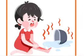 一周内多例儿童烫伤 医生：烫伤后的120秒是应对急救的黄金时间 不要用冰块冷敷创面图片