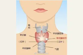 一般甲状腺结节分为哪几类？图片